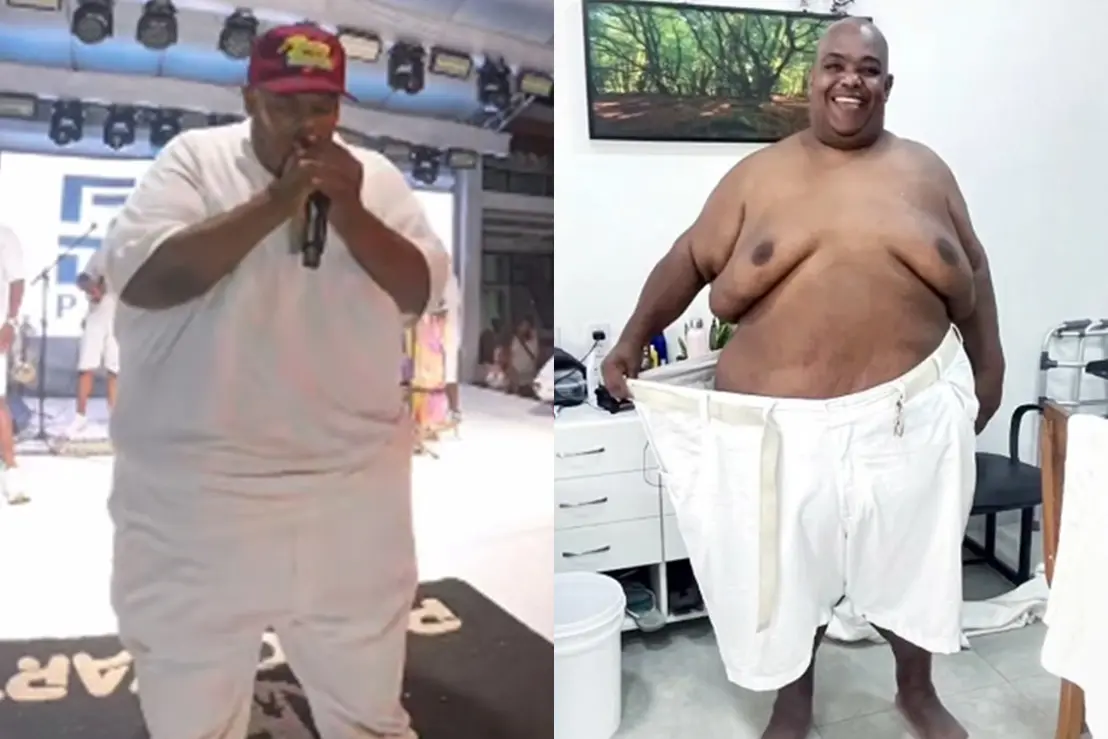 Descubra como o vocalista da banda Pagodart conseguiu eliminar 108 kg e transformar radicalmente sua rotina e saúde. Confira os detalhes!