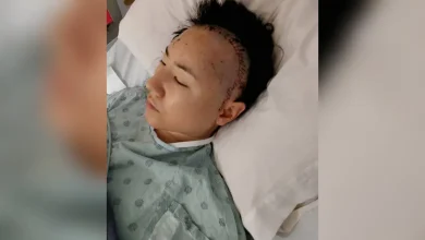 Mulher grávida de 35 semanas sofre AVC isquêmico e descobre condição cerebral rara após investigação médica detalhada. Leia a matéria completa.