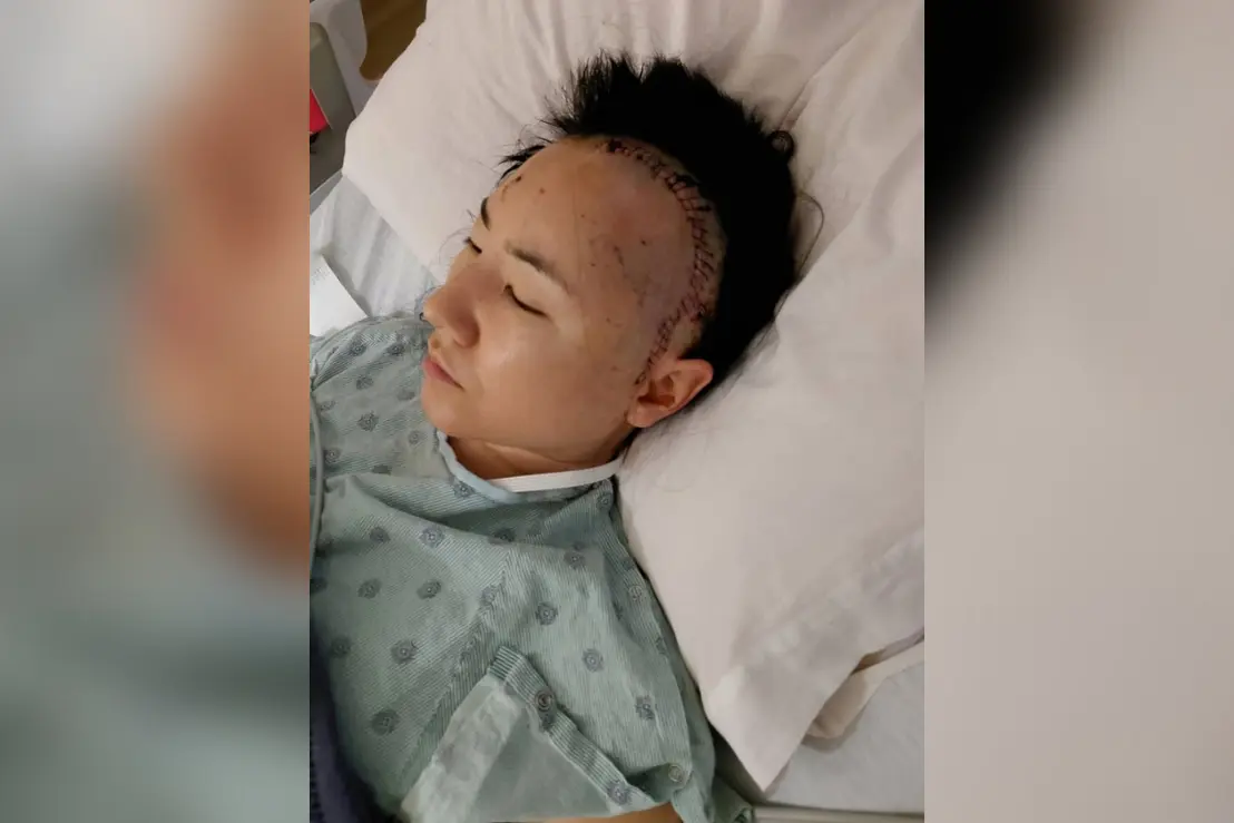 Grávida de 35 semanas sofre AVC e descobre doença rara 6 Mulher grávida de 35 semanas sofre AVC isquêmico e descobre condição cerebral rara após investigação médica detalhada. Leia a matéria completa.